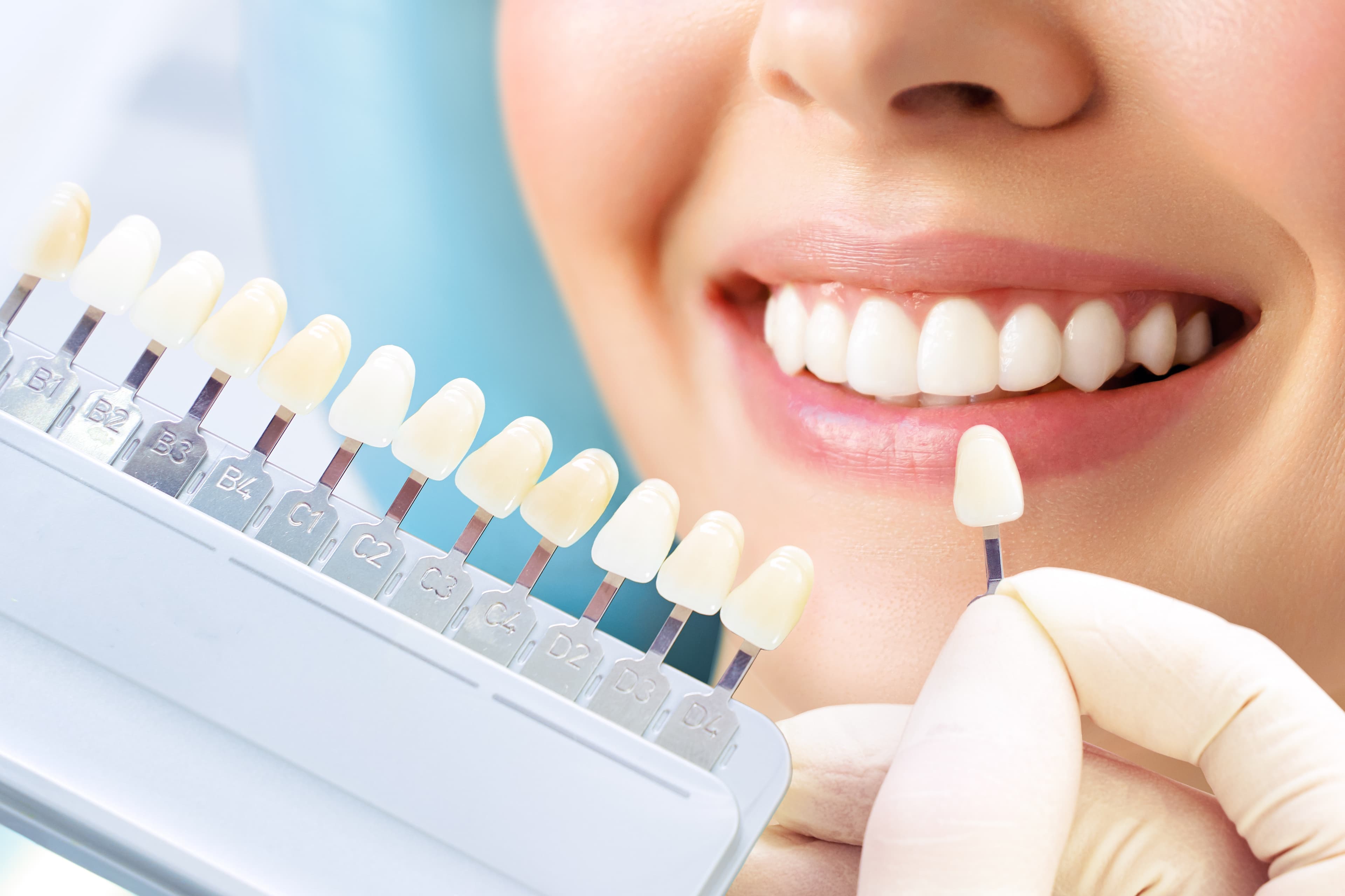 Smile Enhancement